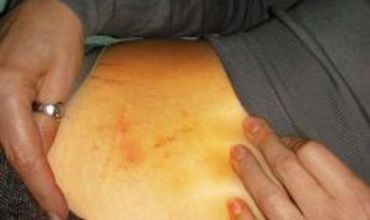 Cum arată Iulia Timoşenko după o săptămână de grevă a foamei şi după ce a fost agresată în închisoare
